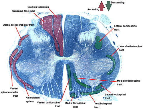 Round 10: A Potpourri of Neurological Cases: Question - Is it Rheumatic ...